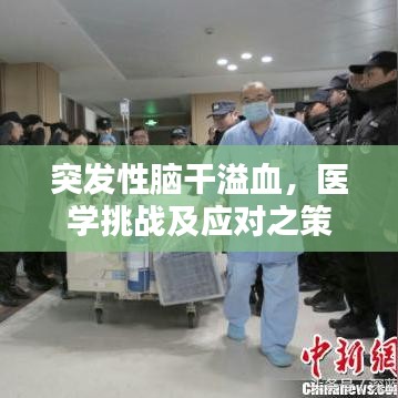 突发性脑干溢血，医学挑战及应对之策