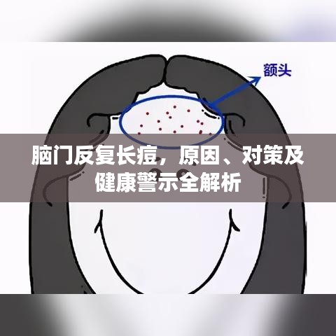 脑门反复长痘，原因、对策及健康警示全解析