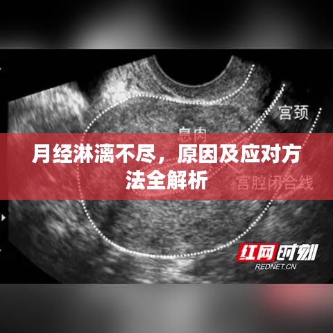 月经淋漓不尽，原因及应对方法全解析