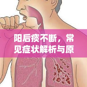 阳后痰不断，常见症状解析与原因探究