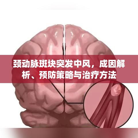 颈动脉斑块突发中风，成因解析、预防策略与治疗方法